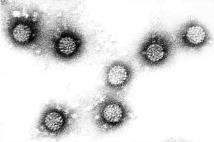 İnsan papilloma virüsü